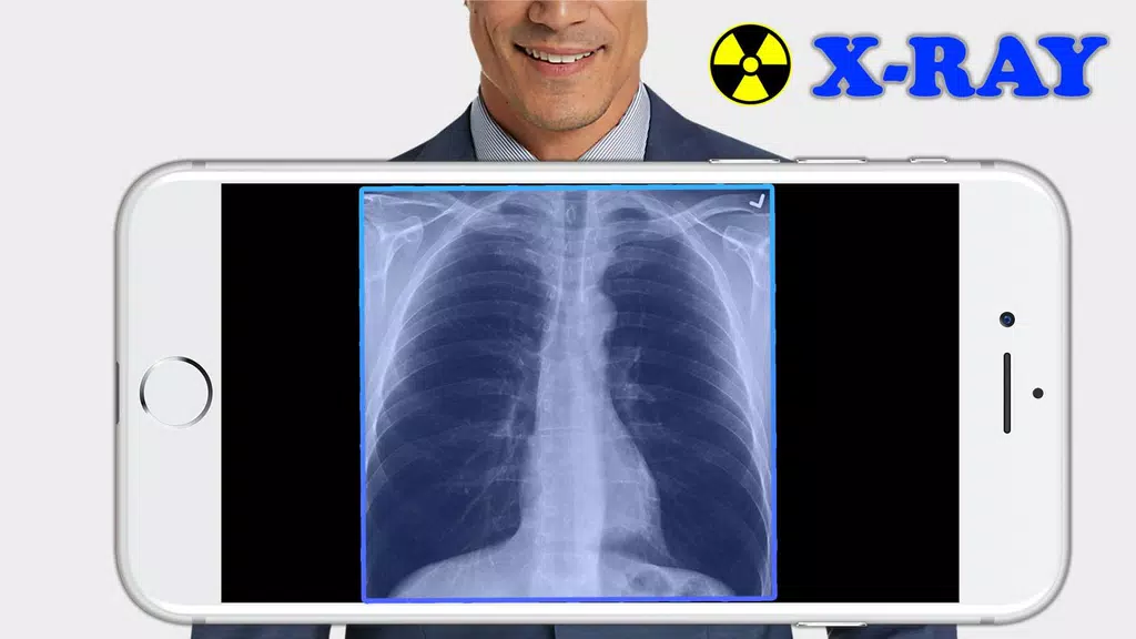 X-Ray Filter Photo Скриншот 0