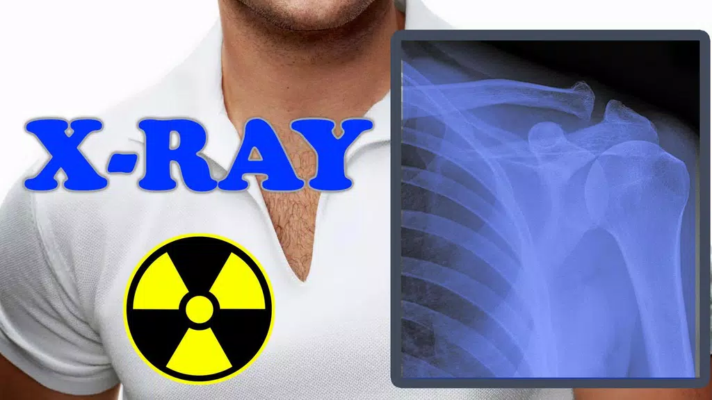 X-Ray Filter Photo Скриншот 2